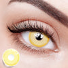 Yellow Sunbeam Eyes | 1 Year