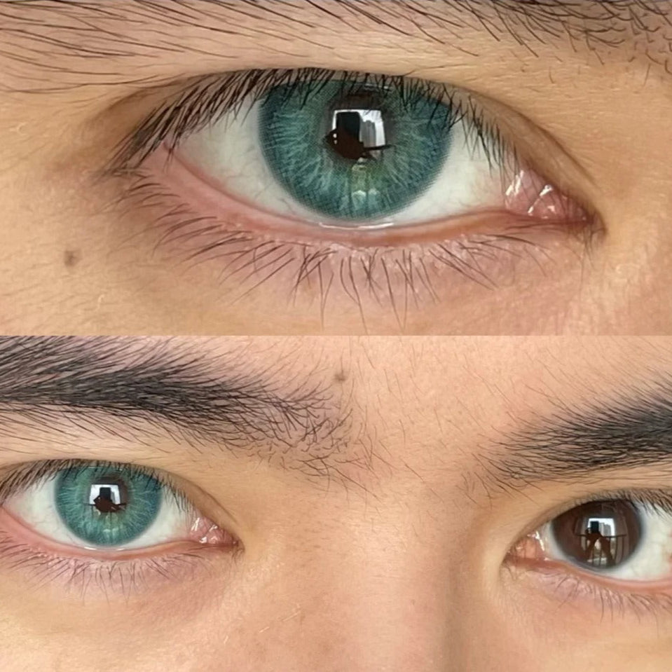 Forest Spark Green | 6 Months